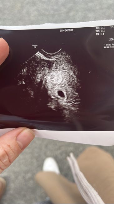 Futuras mamás Octubre 2022 🤰♥️ 1
