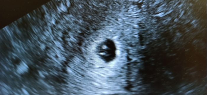 Futuras mamás Octubre 2022 🤰♥️ 3