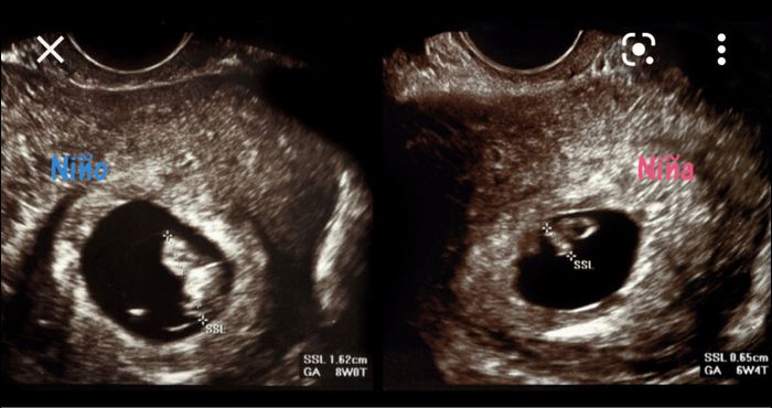 Futuras mamás Octubre 2022 🤰♥️ 1