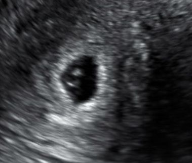 Futuras mamás Octubre 2022 🤰♥️ 5