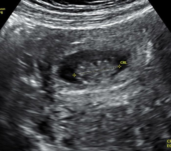 Futuras mamás Octubre 2022 🤰♥️ 6