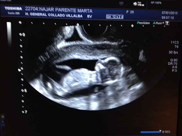 El consultorio de Lita para futuras mamis - 1