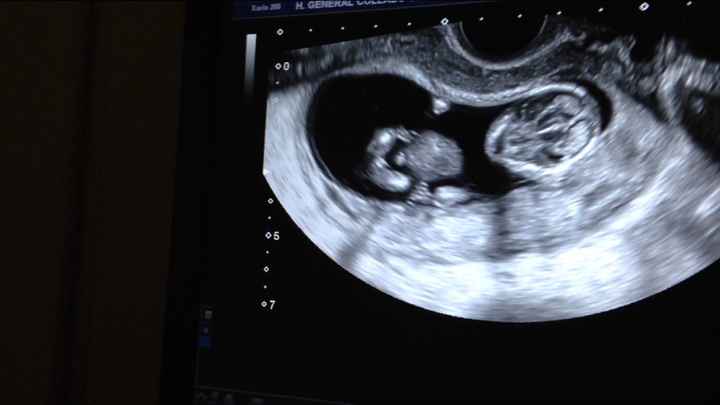 El consultorio de Lita para futuras mamis - 2