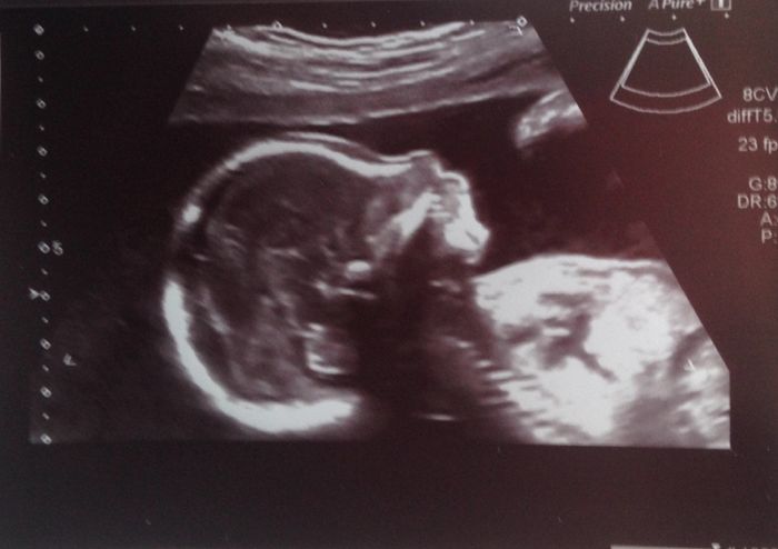 Super mamás julio 2015!! :) - 2