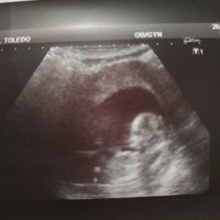 Futuras mamás Junio 2020 - 1
