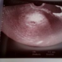 Buscadoras de sueños y milagros: IA, FIV, ICSI (Reproducción Asistida) - 1