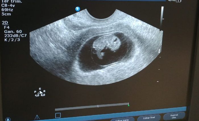 Futuras Mamas Julio 2020. - 1
