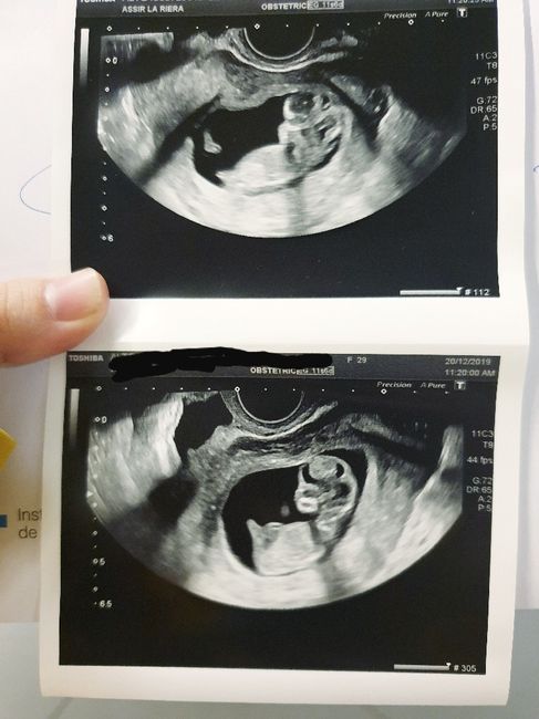 Futuras Mamas Julio 2020. - 1