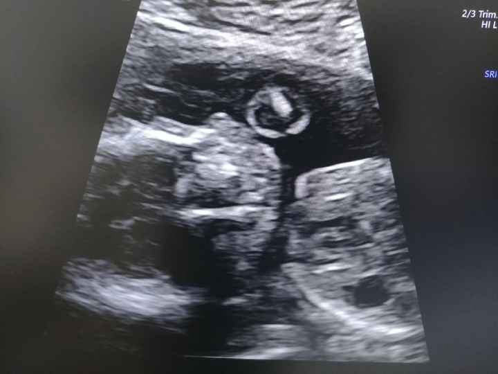 Futuras Mamas Julio 2020. - 1
