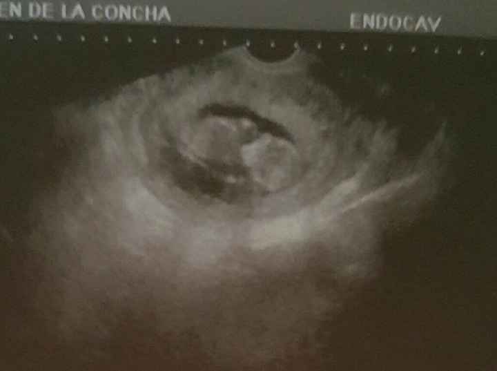 Futuras mamás enero 2017 - 1