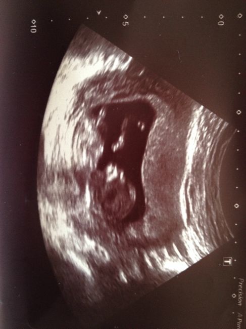 Mamis enero 2016 - 1