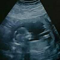 Futuras mamas septiembre 2016 - 1