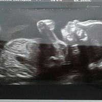 Nuevo! futuras mamis noviembre 2017 - 2