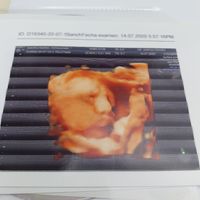 Futuras mamas octubre 2020 - 1