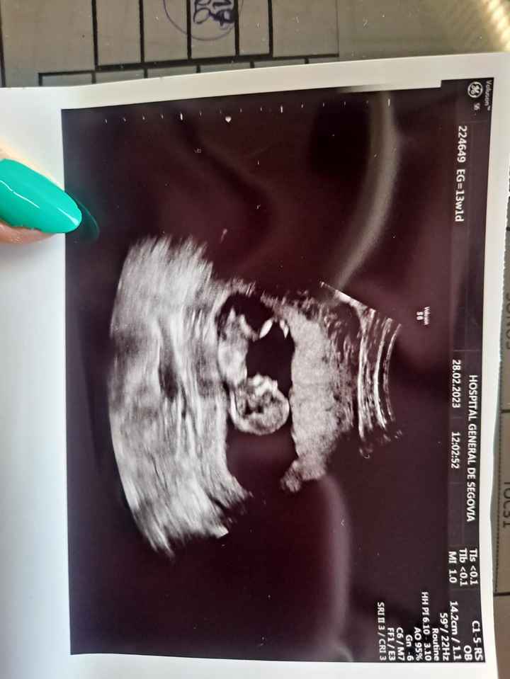 Método Ramzi - 4