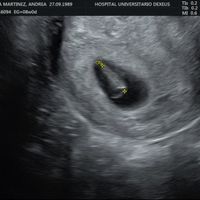 Futuras Mamas Julio 2020. - 1