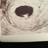 👶🏻futuras mamis febrero 2022👶🏻 - 1