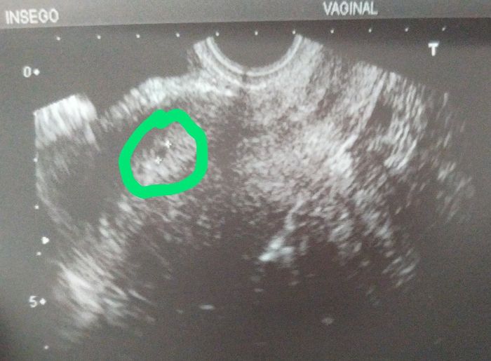 Futuras mamás Junio 2021 1