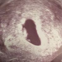 Buscadoras de sueños y milagros: IA, FIV, ICSI (Reproducción Asistida) - 1