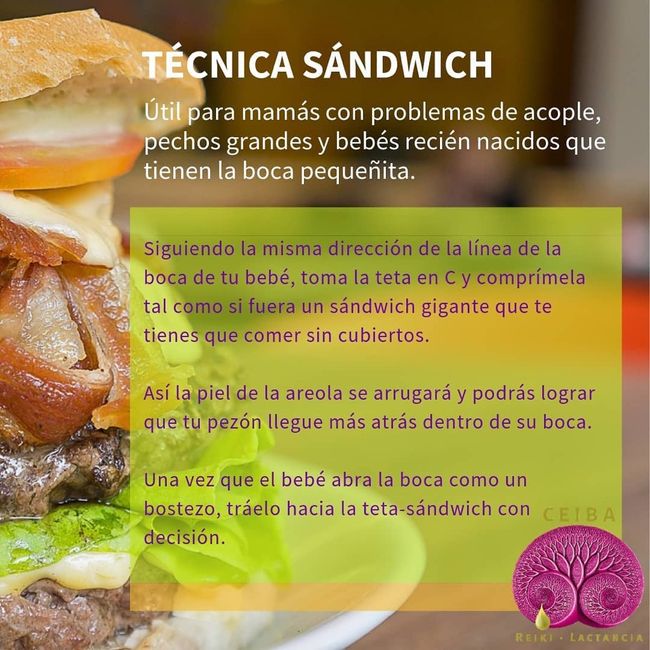 Técnica sándwich 