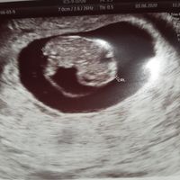 Futuras Mamis Enero 2021 - 1