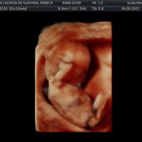 👶🏻futuras mamis febrero 2022👶🏻 - 1