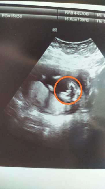 Futuras mamas Diciembre 2020 - 1
