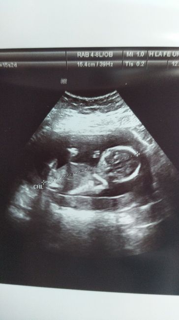 Futuras mamas Diciembre 2020 - 2