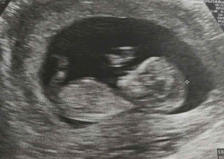 Futuras mamas Diciembre 2020 - 1