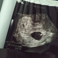 Ayuda con método ramzi: niño o niña? - 1