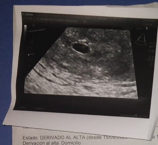 Ayuda con método ramzi: niño o niña? - 1