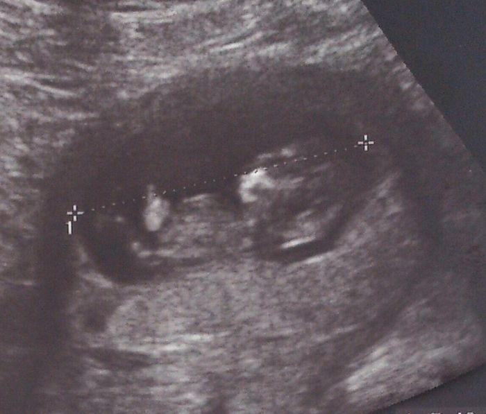 10 semanas