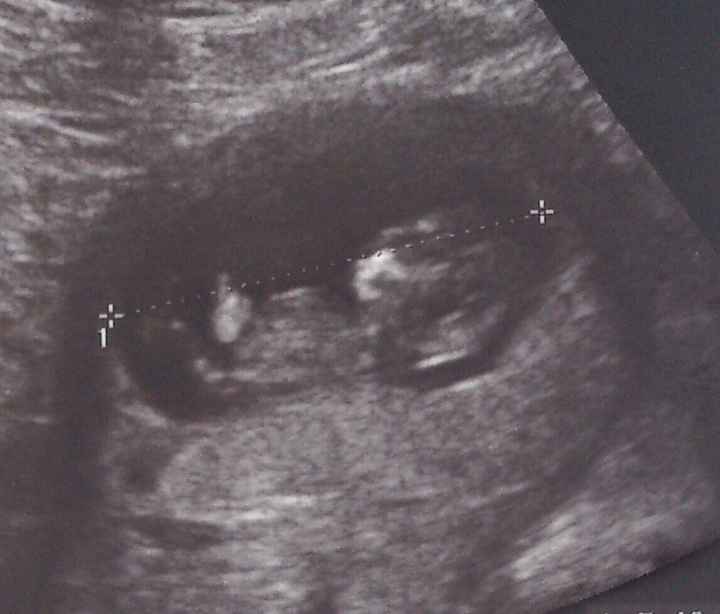 10 semanas