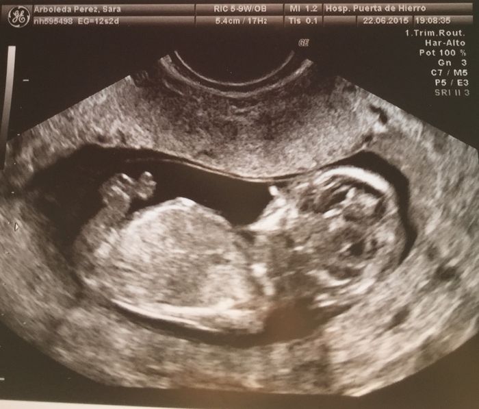 mi bebe 12+2