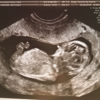 mi bebe 12+2