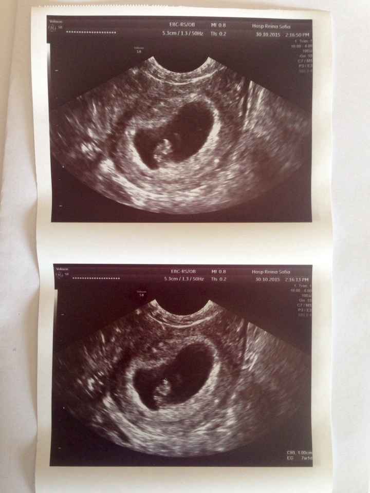 Futuras mamás junio 2016 - 1