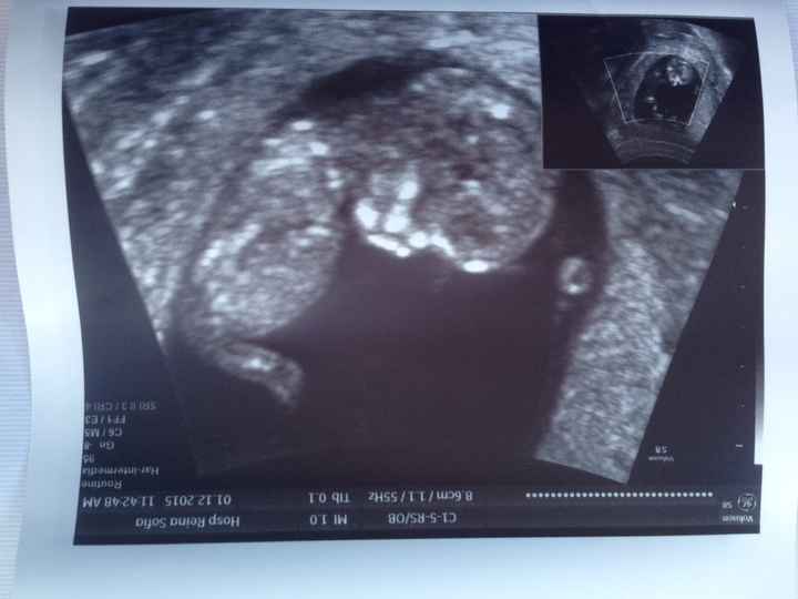 Futuras mamás junio 2016 - 1
