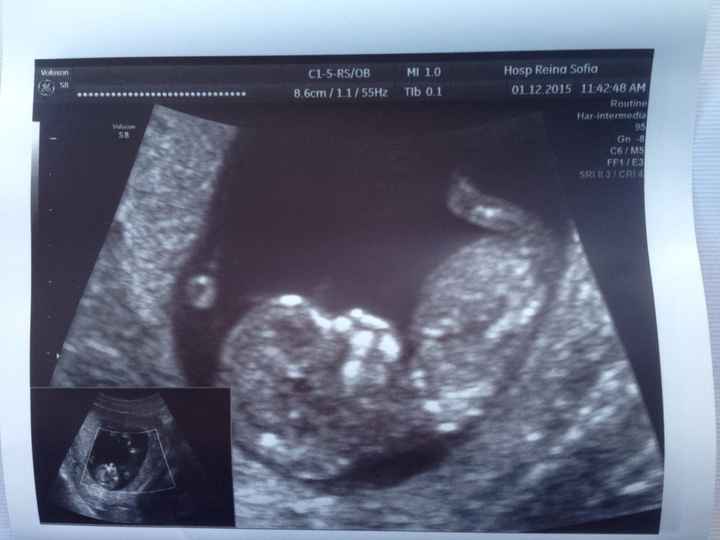 El consultorio de Lita para futuras mamis - 1