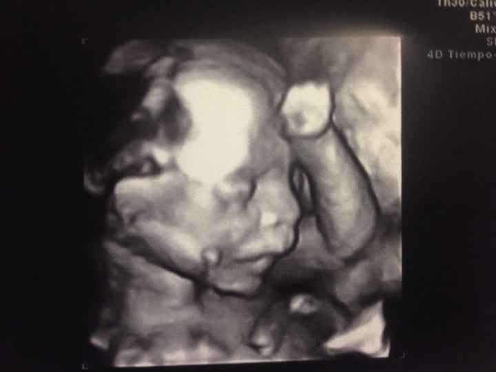 Futuras mamás junio 2016 - 1