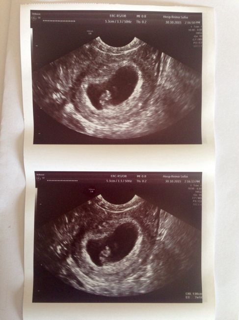 Futuras mamás junio 2016 - 1