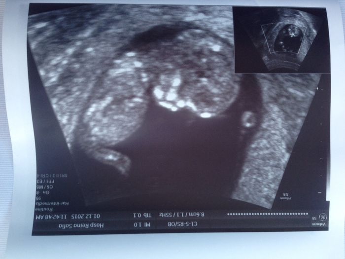 Futuras mamás junio 2016 - 1