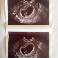 Futuras mamás junio 2016 - 1