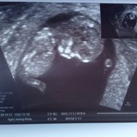 Futuras mamás junio 2016 - 1