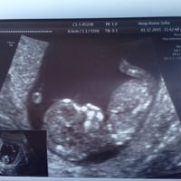 El consultorio de Lita para futuras mamis - 1