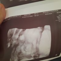 Futuras Mamis Enero 2021 - 1