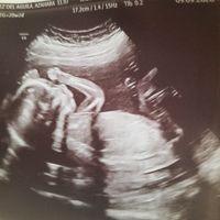 Futuras Mamis Enero 2021 - 2