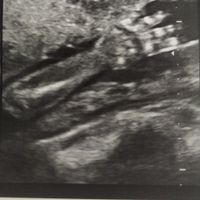 Futuras mamis Febrero 2021 - 1