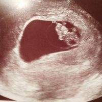 Futuras mamás enero 2017 - 1