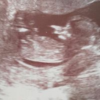 Futuras mamás enero 2017 - 1