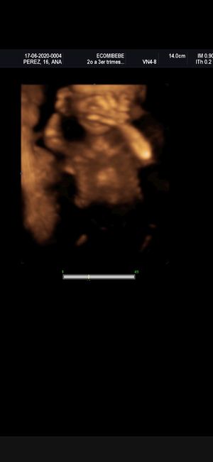Futuras mamas noviembre 2020 - 1